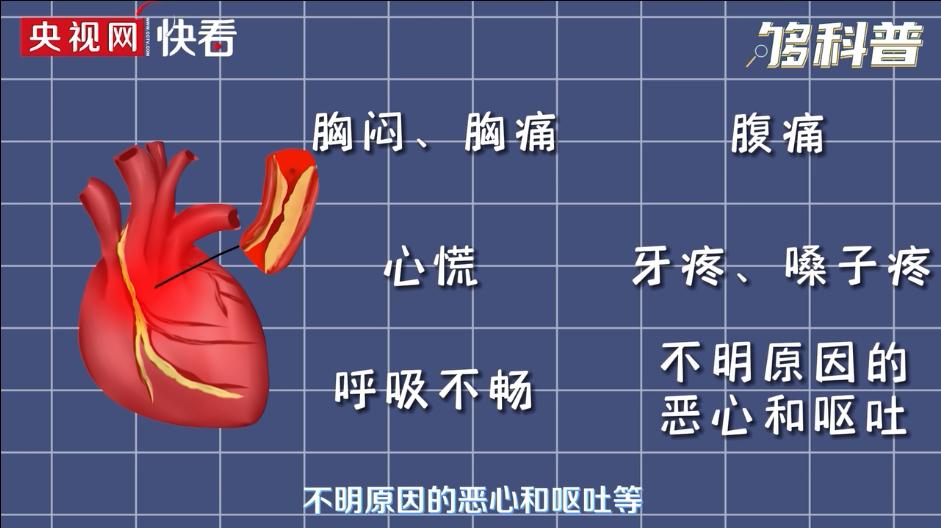 别不当回事!男子牙疼数日,没想到是心肌梗死……
