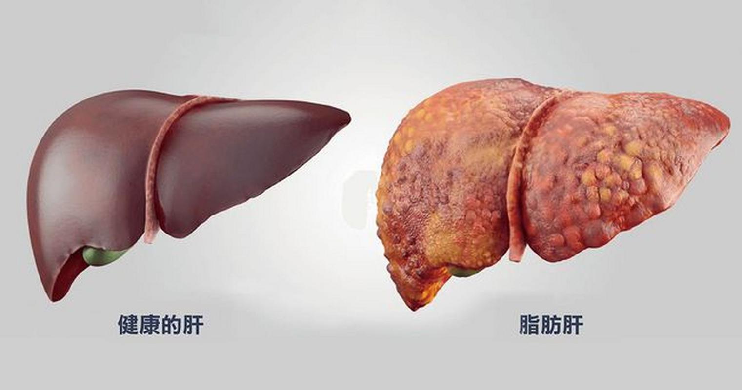医生直言:经常不吃晚餐,除了可以变瘦,或还可以缓解这6个问题
