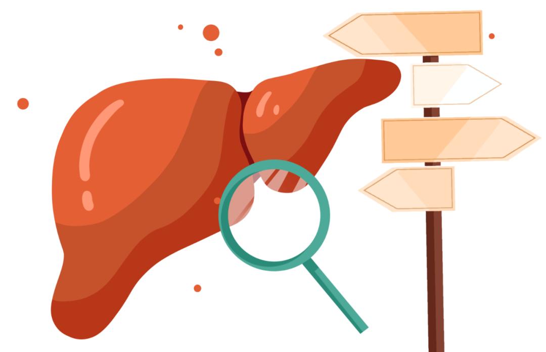 Hepatology丨HESV20优于GALAD评分系统,有望成为肝细胞癌早期