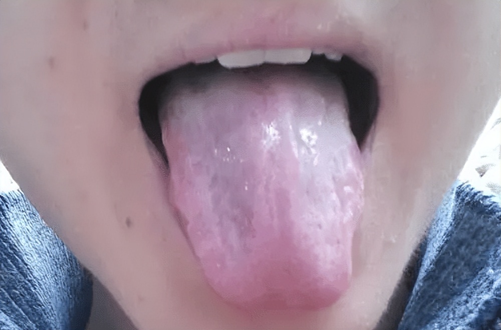人能活多久,看舌头就能知道?寿命长的人,舌头多会有这几种表